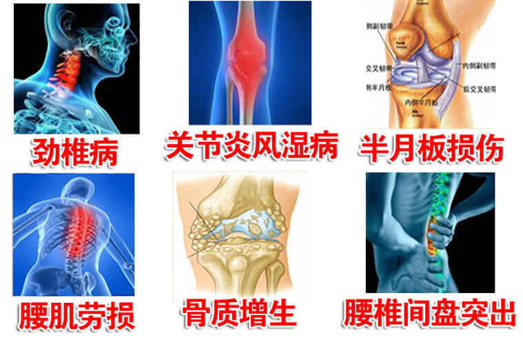 膏药正品官网