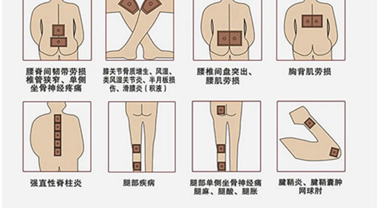 膏药贴片的用法